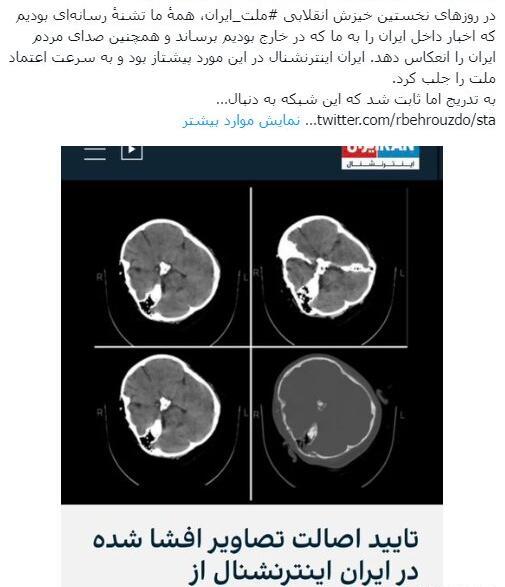 عکس مهسا امینی روی اسکناس