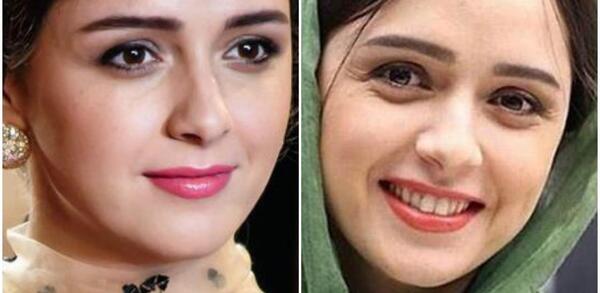 عکس خالکوبی روی دست ارسلان مطهری