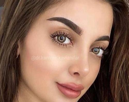 عکس دختر دماغ عملی خوشگل برای پروفایل