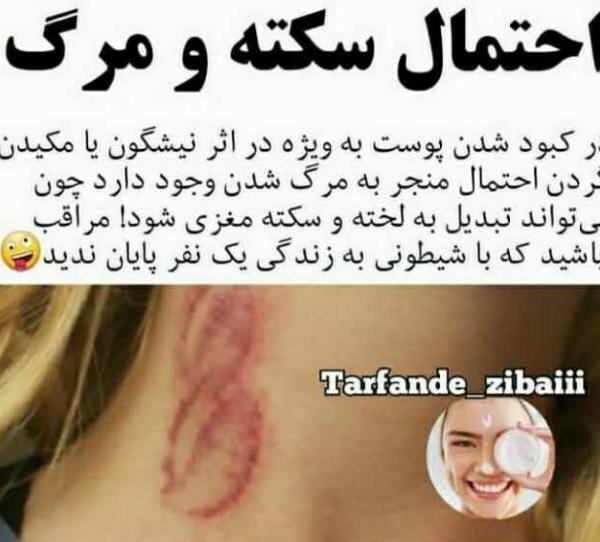عکس کبود شدن گردن عاشقانه