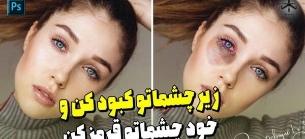 عکس کبود شدن گردن عاشقانه