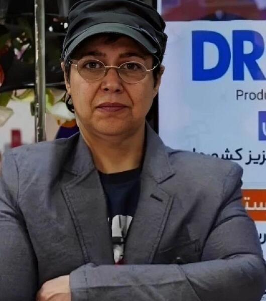عکس شهره لرستانی قبل از عمل