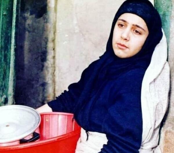 عکس شهره لرستانی قبل از عمل