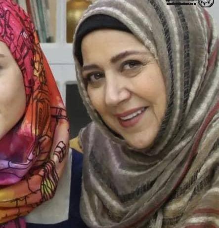 عکس شهره لرستانی قبل از عمل