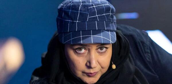 عکس شهره لرستانی قبل از عمل