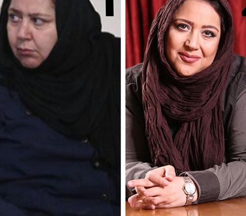عکس شهره لرستانی قبل از عمل