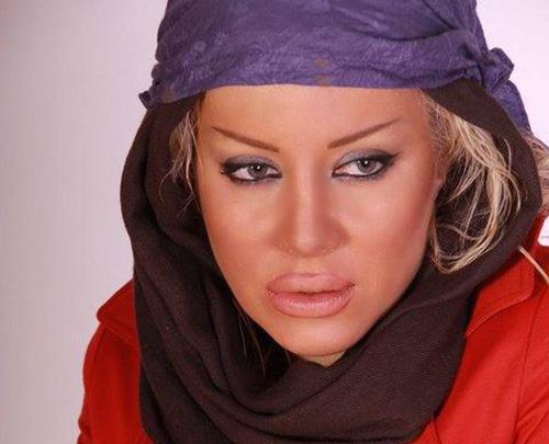عکس شراره رخام قبل از عمل