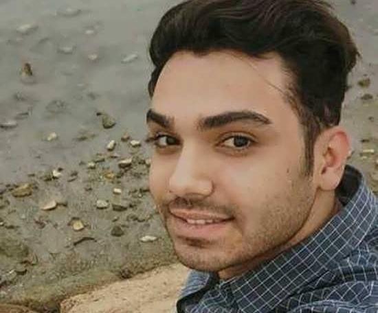 عکس سینا درخشنده قبل از عمل