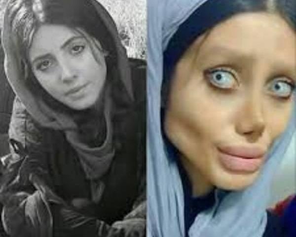 عکس سینا درخشنده قبل از عمل
