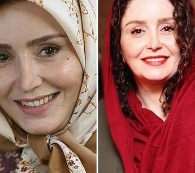 عکس های بهاره افشاری قبل از عمل بینی