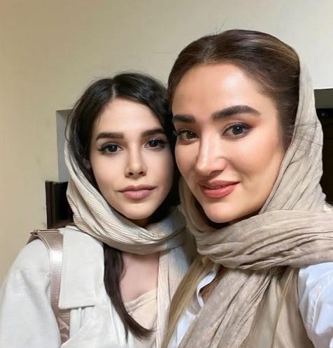 عکس های بهاره افشاری قبل از عمل بینی