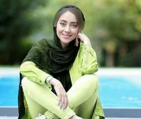 عکس های بهاره افشاری قبل از عمل بینی