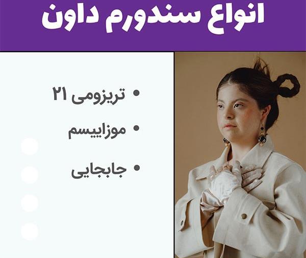 عکس کودک سندروم داون