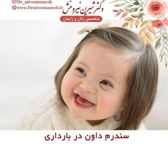 عکس کودک سندروم داون
