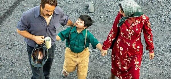 عکس کودک سندروم داون