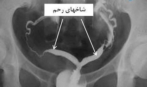 عکس نوشته فلسفی درباره زندگی