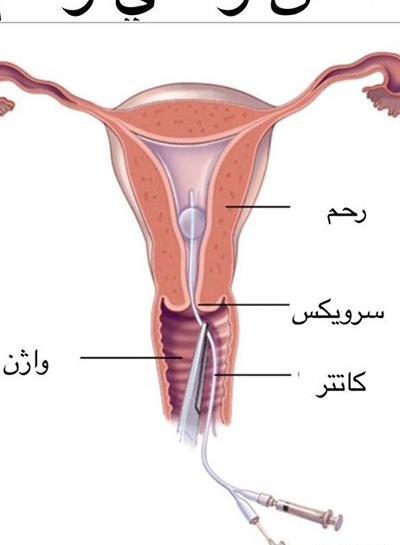 عکس نوشته فلسفی درباره زندگی