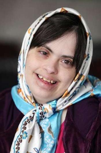 عکس دختر عقب مانده ذهنی