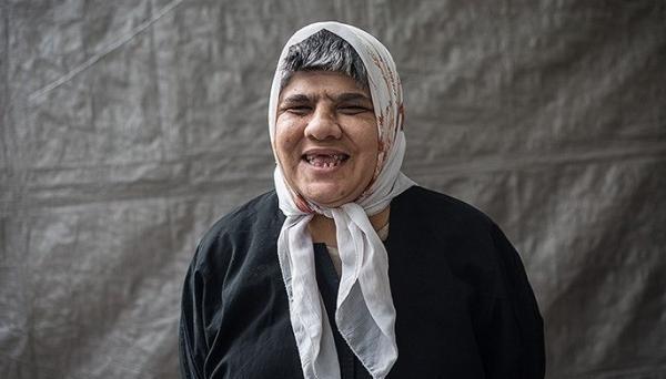عکس دختر عقب مانده ذهنی