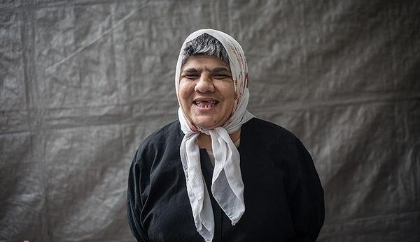 عکس دختر عقب مانده ذهنی