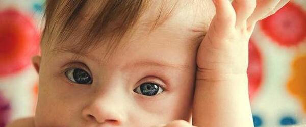 عکس دختر عقب مانده ذهنی