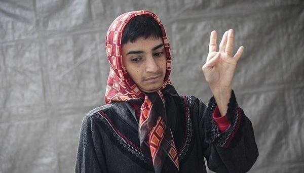 عکس دختر عقب مانده ذهنی
