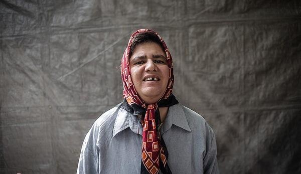 عکس دختر عقب مانده ذهنی