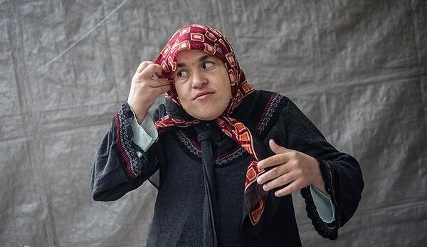 عکس دختر عقب مانده ذهنی