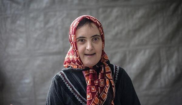 عکس دختر عقب مانده ذهنی