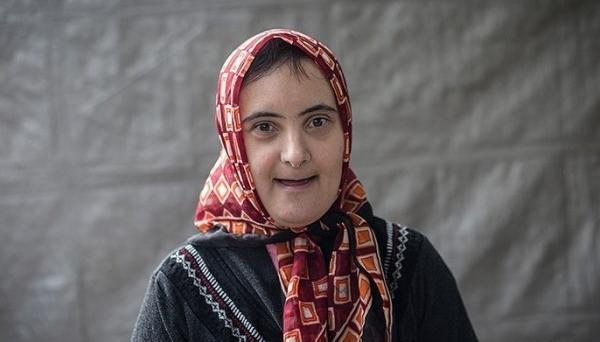 عکس دختر عقب مانده ذهنی
