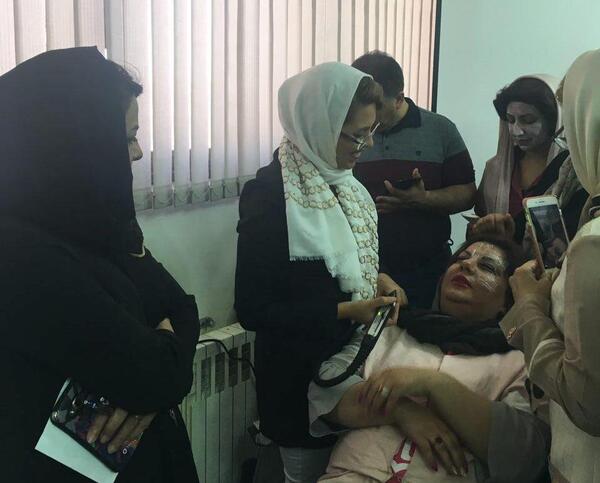 عکس دستگاه لیزر ایلایت
