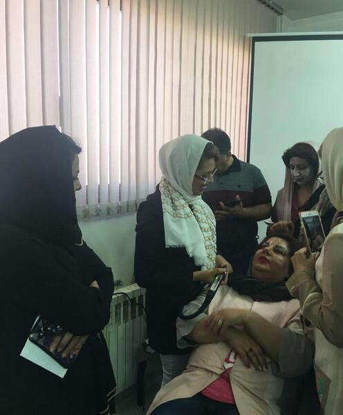 عکس دستگاه لیزر ایلایت