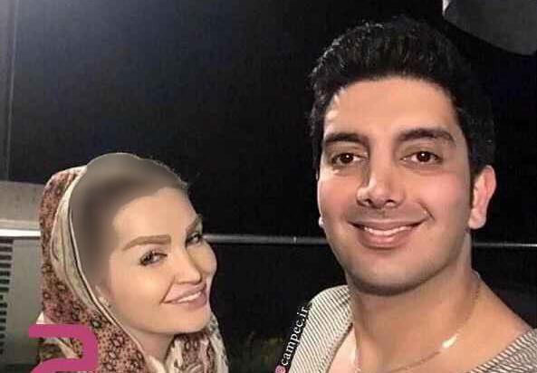 عکس باران خواننده قبل از عمل
