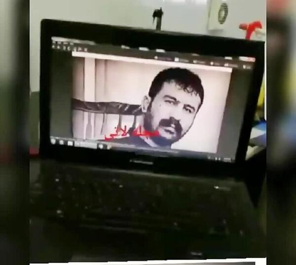 عکس صورت وحید مرادی