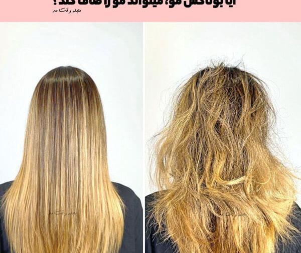 عکس قبل بعد بوتاکس