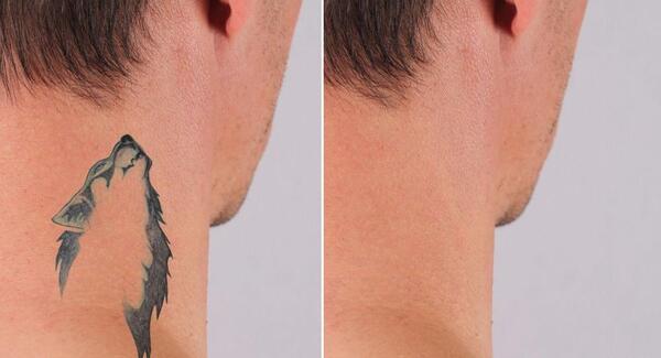 عکس طرح تاتو روی گردن مردانه