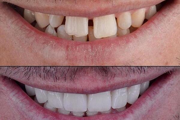 عکس دختر با لبخند جذاب
