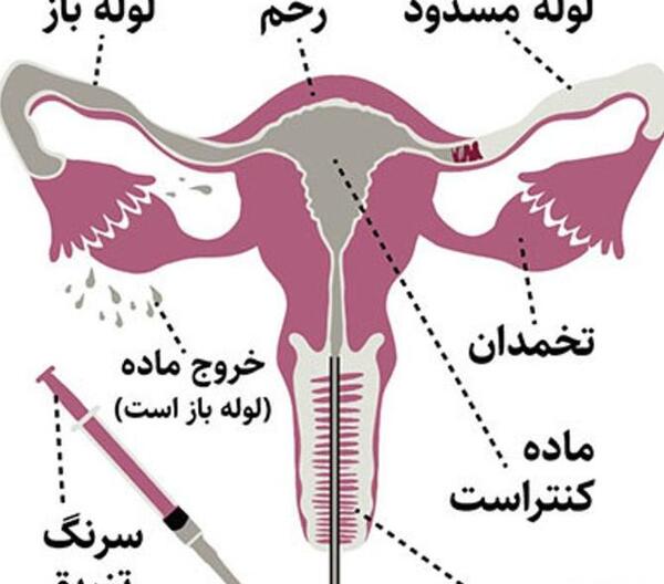 عکس چت رفیق برای پروفایل
