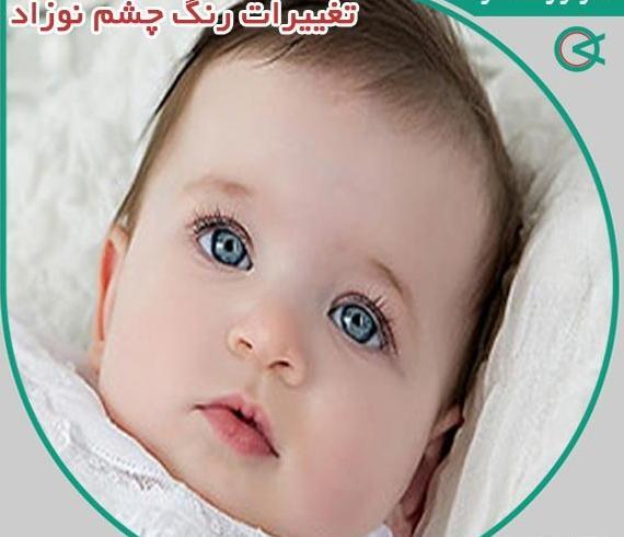 عکس نوزاد پسر چشم رنگی
