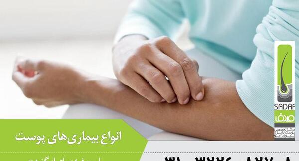 عکس ویروس قارچ