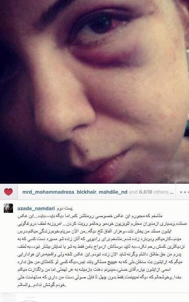 عکس صورت کبود آزاده نامداری
