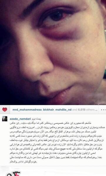 عکس صورت کبود آزاده نامداری