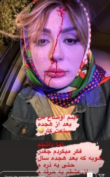 عکس سیاه و سفید نیوشا ضیغمی