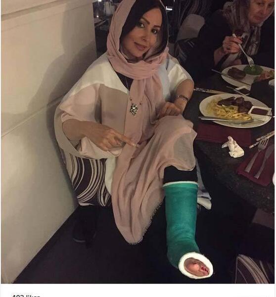 عکس پای شکسته پرستو صالحی