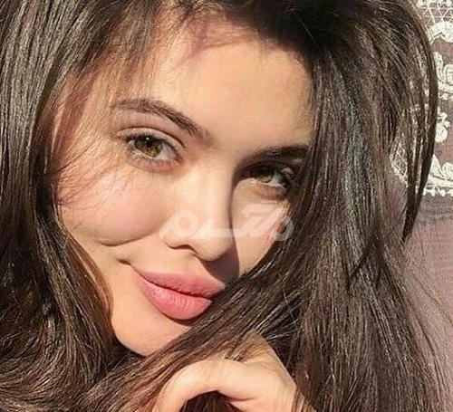 عکس ضرب واضح
