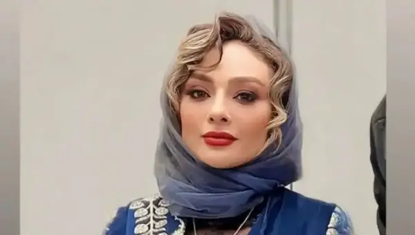 عکس کبودی چشم آزاده نامداری