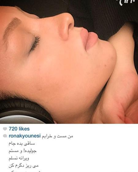 عکس کبودی چشم آزاده نامداری