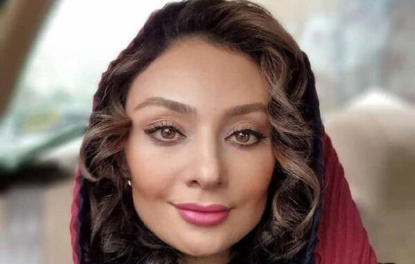 عکس کبودی چشم آزاده نامداری