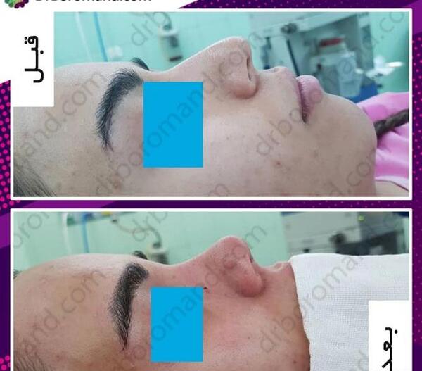 عکس چاقو اتاق عمل