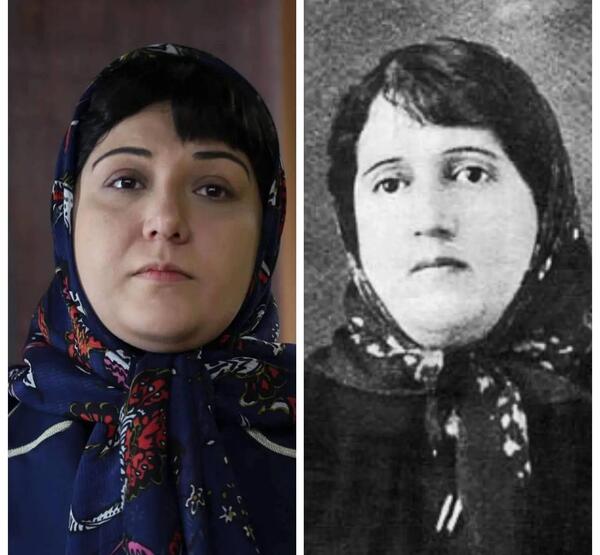 عکس باران کوثری قبل از عمل بینی